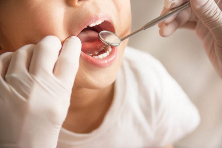dentist looking into child's mouth
