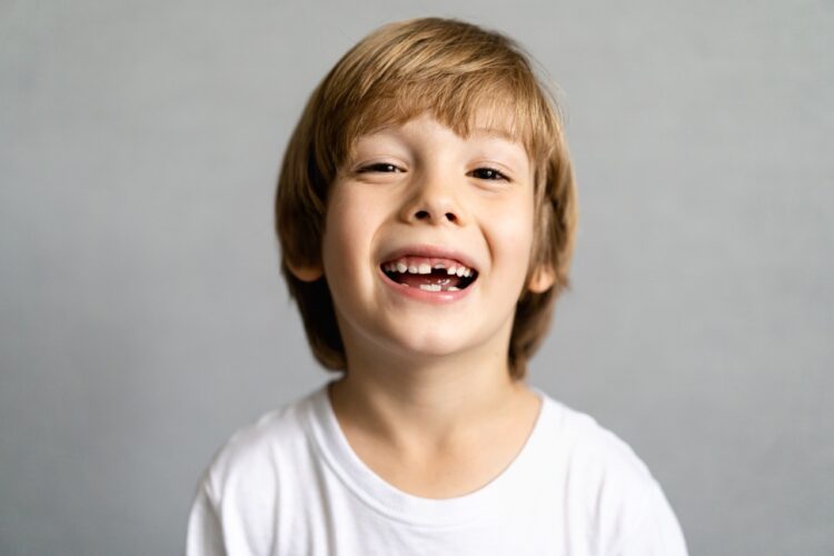 kid missing his front teeth smiles